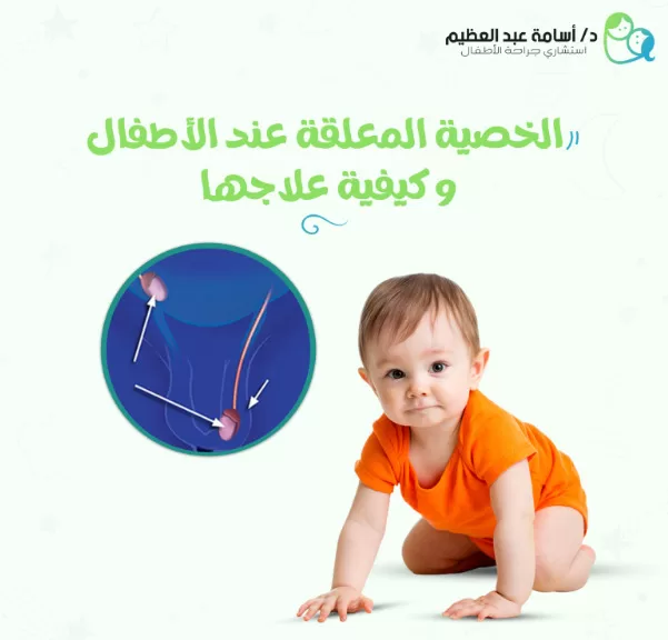 الخصية المعلقة عند الأطفال