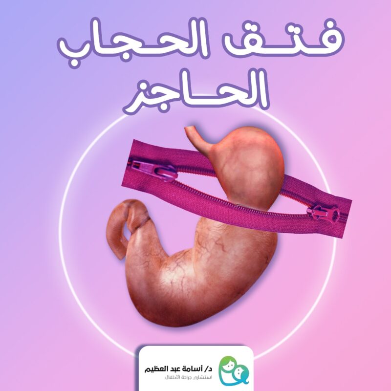 فتق الحجاب الحاجز عند الاطفال