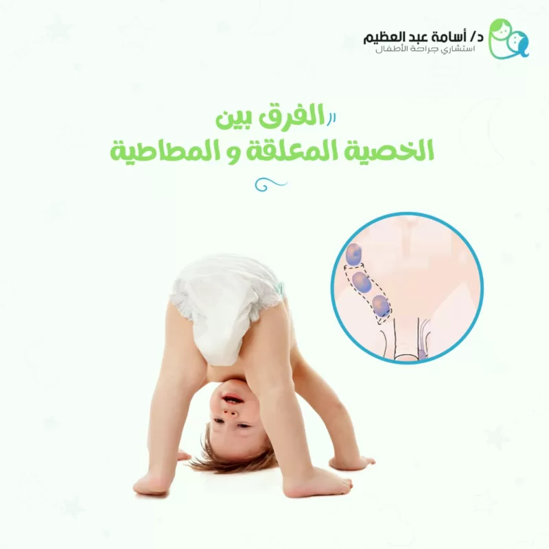 الخصية المعلقة والمطاطية