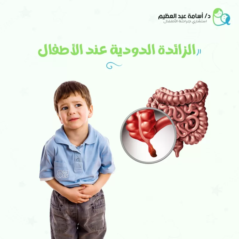 الزائدة الدودية عند الأطفال 